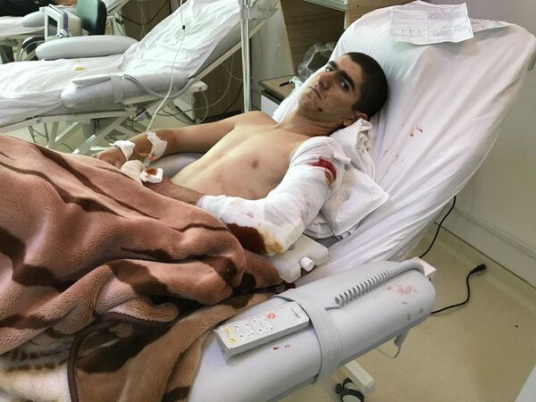 Ադրբեջանական հրետակոծությունից վիրավորված քաղաքացի - Sputnik Արմենիա