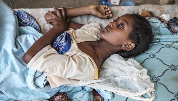 Девушка, пострадавшая в ходе боевых действий в Хумере, Эфиопия - Sputnik Армения