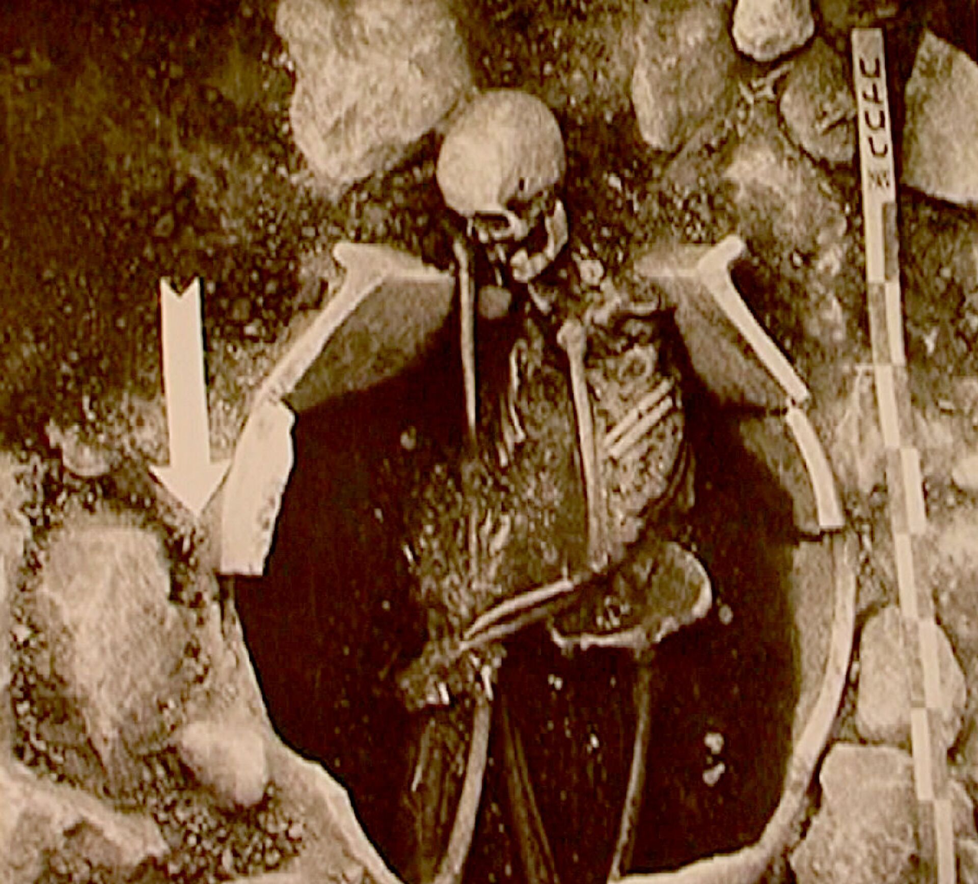 Как выглядели наши далекие предки, и как они делали трепанацию черепа - находки в Лчашене - Sputnik Армения, 1920, 09.05.2021