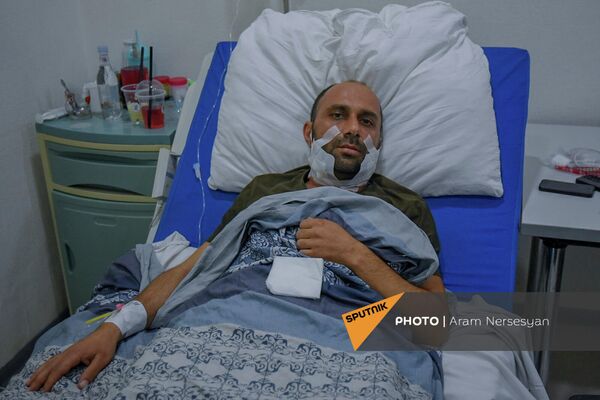 Получивший ранение от рук азербайджанского военнослужащего Арам Саркисян в медцентре в Степанакерте - Sputnik Армения