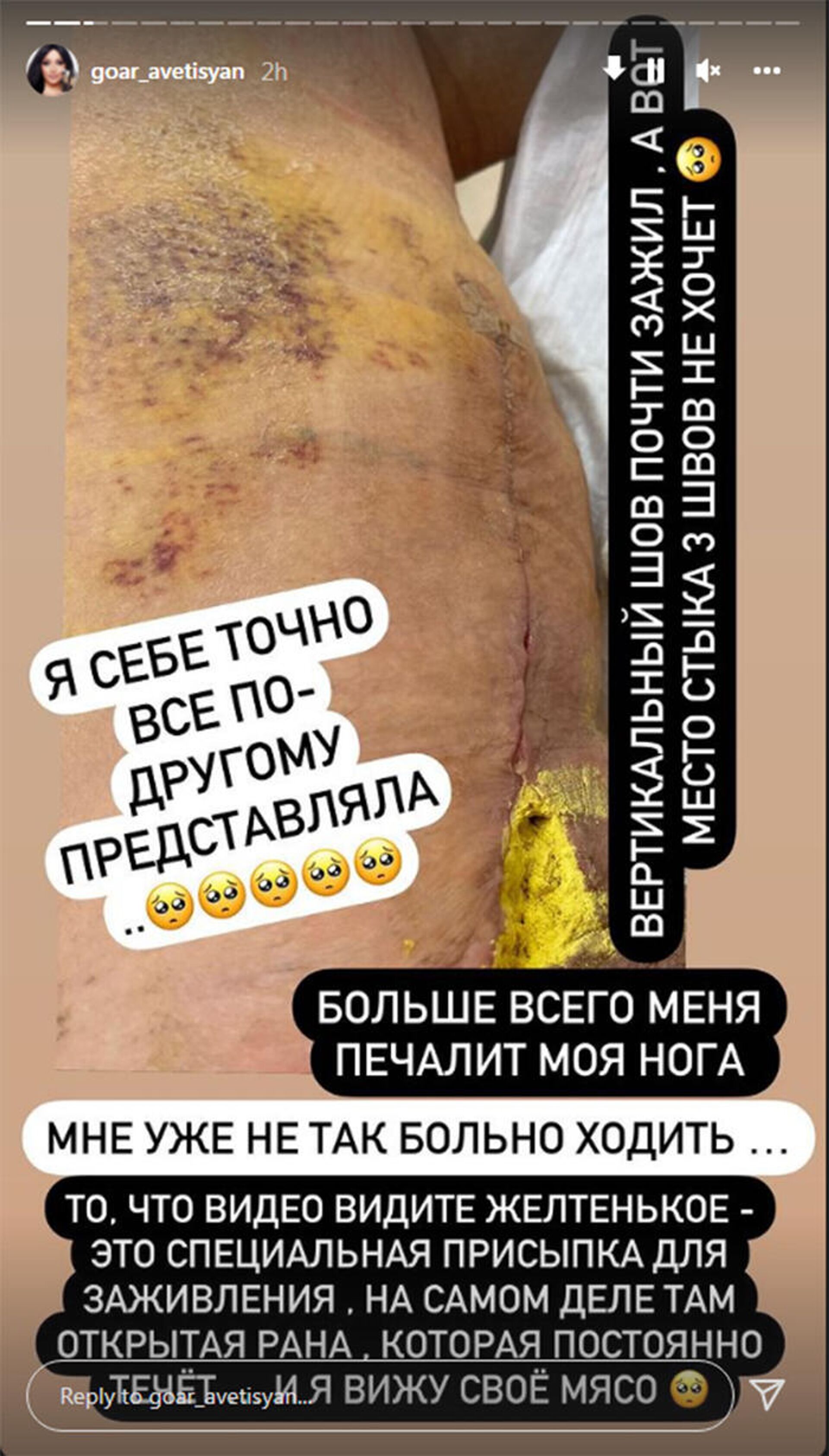 Instagram story Гоар Аветисян - Sputnik Армения, 1920, 12.12.2021