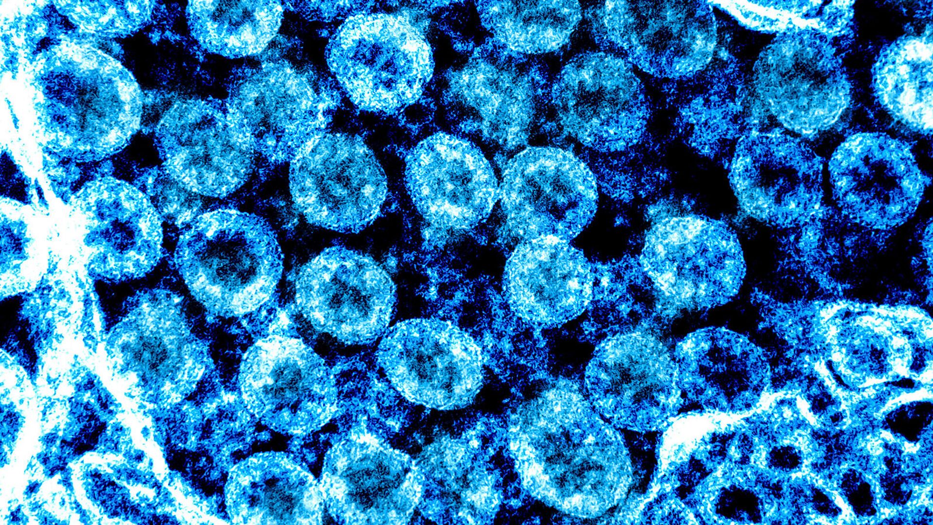 Микрофотография с улучшением цвета просвечивающего электрона вирусных частиц SARS-CoV-2, выделенных у пациента - Sputnik Армения, 1920, 01.12.2021
