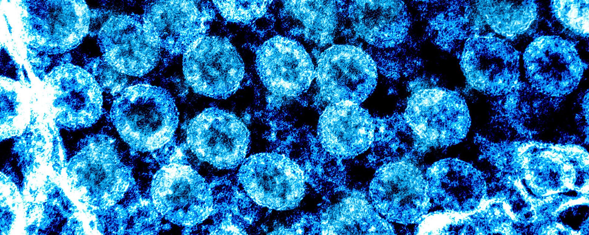 Микрофотография с улучшением цвета просвечивающего электрона вирусных частиц SARS-CoV-2, выделенных у пациента - Sputnik Армения, 1920, 01.12.2021