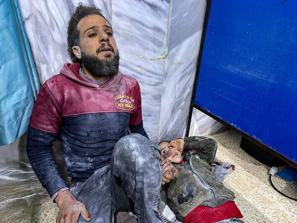 Раненый ребенок в ожидании медицинской помощи в больнице Баб аль-Хава после землетрясения в сирийской провинции Идлиб - Sputnik Армения