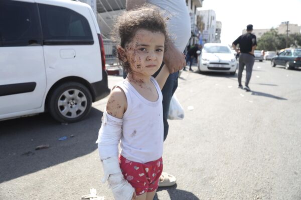 Գազայի հատվածում Իսրայելի զինված ուժերի հրթիռային հարվածների հետևանքով տուժած երեխա - Sputnik Արմենիա