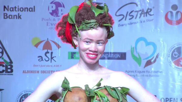Конкурс красоты среди альбиносов Африки провели в Кении - Sputnik Արմենիա
