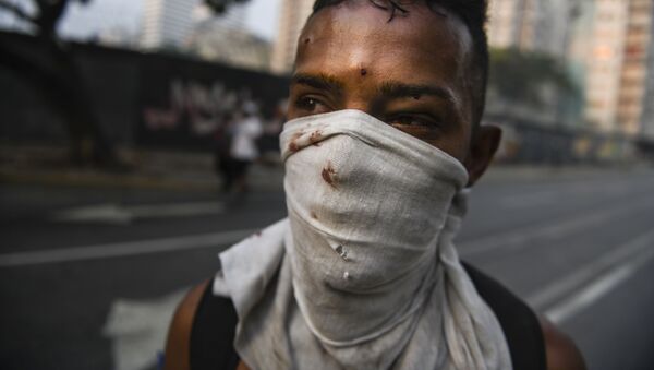 Протестующий, раненный в столкновениях с Национальной гвардией Венесуэлы в Альтамире, районе Каракаса - Sputnik Армения