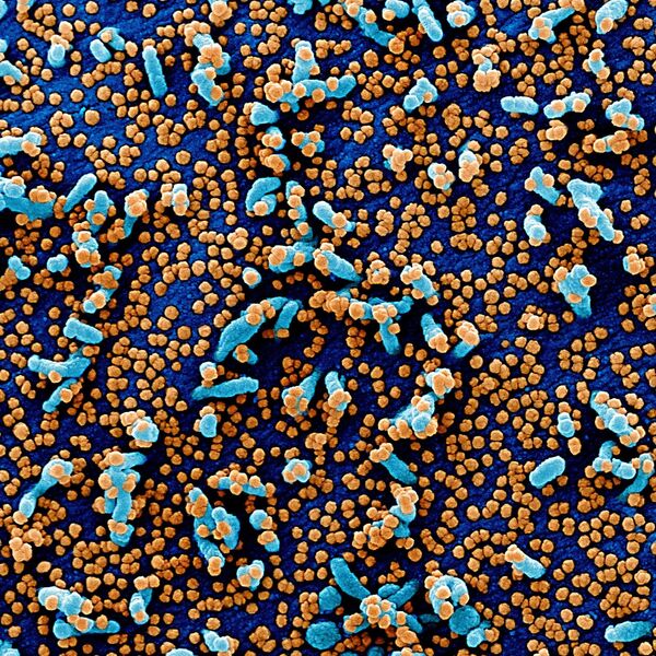 Вид на зараженную коронавирусом клетку под микроскопом - Sputnik Армения