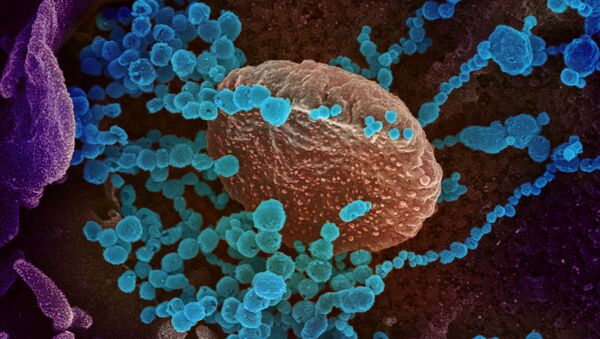 Вид на зараженную коронавирусом  клетку под микроскопом  - Sputnik Արմենիա