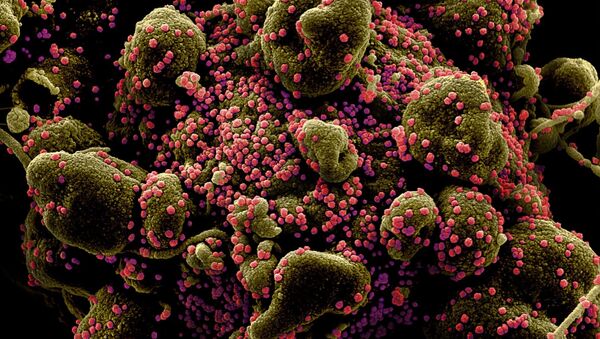 Вид на зараженную коронавирусом клетку под микроскопом - Sputnik Արմենիա