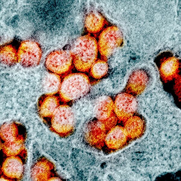 Микрофотография частиц коронавируса в клетке зараженного человека - Sputnik Армения