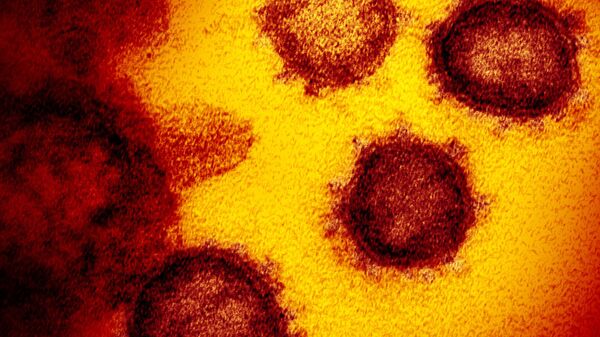 На снимке с помощью электронного микроскопа виден новый коронавирус SARS-CoV-2, появляющийся на поверхности клеток. Он вызывает COVID-19 - Sputnik Армения