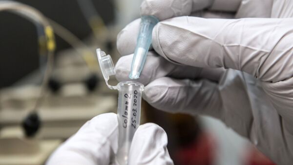 Производство компонентов для тестов на коронавирус в химической лаборатории - Sputnik Армения