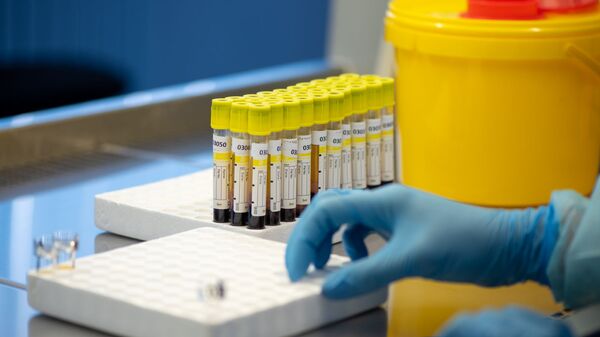 Лаборатория для проведения тестов на антитела к коронавирусу в Республиканском центре профилактики СПИДа - Sputnik Արմենիա