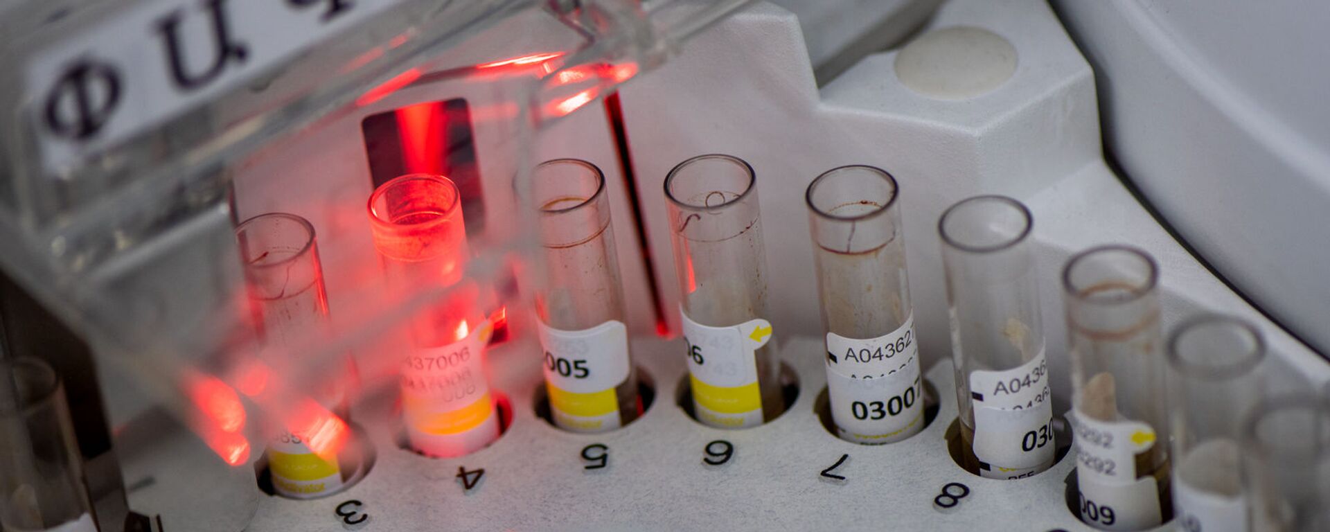 Лаборатория для проведения тестов на антитела к коронавирусу в Республиканском центре профилактики СПИДа - Sputnik Армения, 1920, 02.02.2021