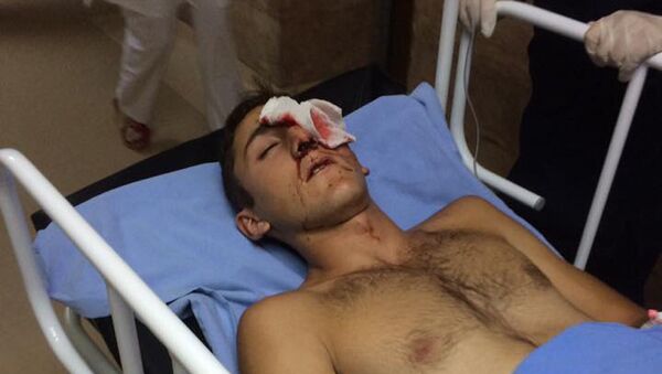 Семнадцатилетний Саят, потерявший глаз в результате разгона демонстрации в Сари тахе - Sputnik Արմենիա
