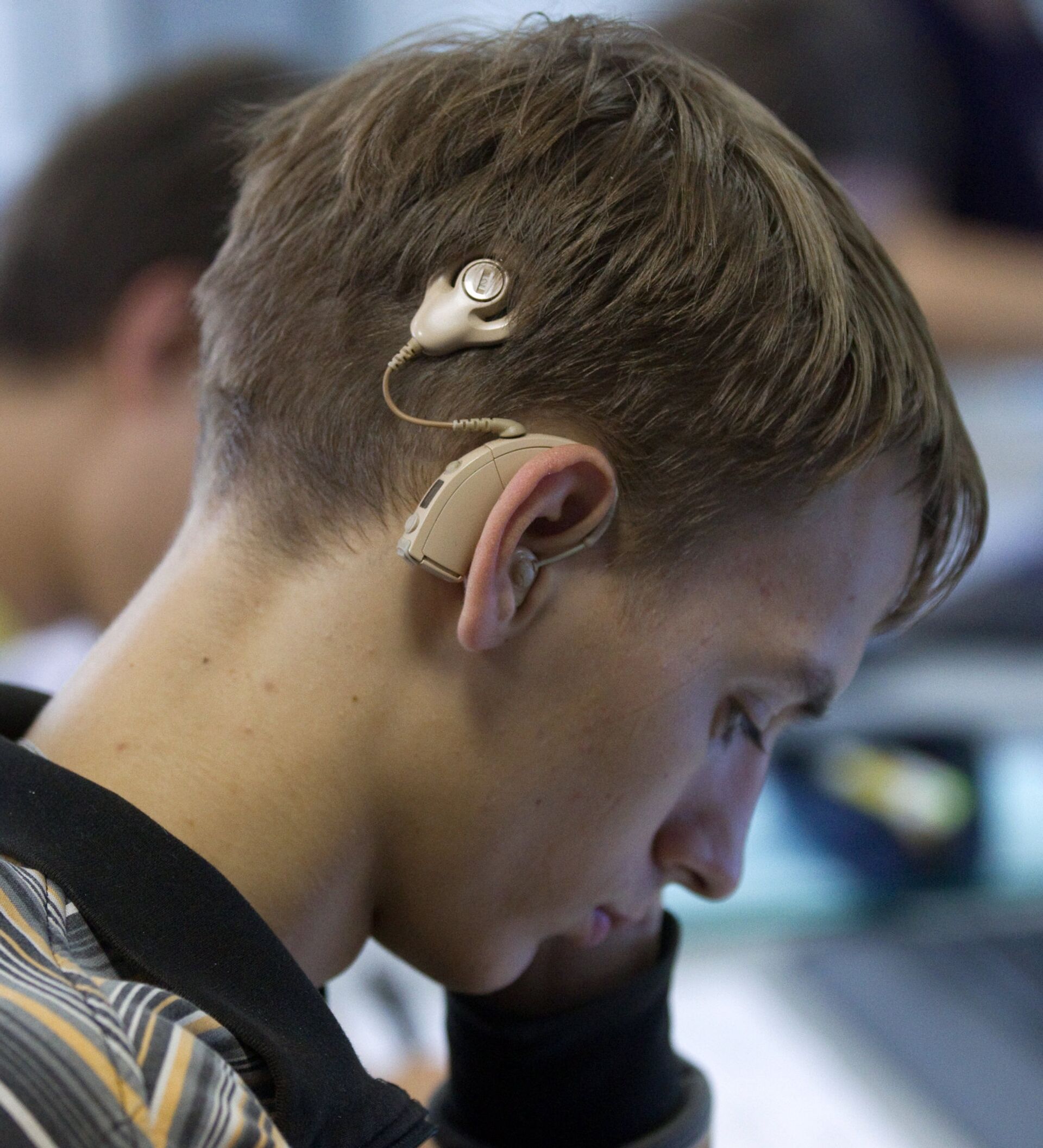 Слабослышащий ученик. Инвалиды по слуху. Люди с нарушением слуха. Слуховые аппараты для инвалидов по слуху. Парень со слуховым аппаратом.